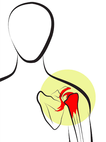 Illustration of the shoulder joint with the joint highlighted in red
