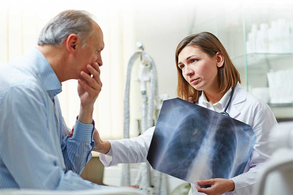 Asbestos exposure and lung cancer — New York asbestos lawyer